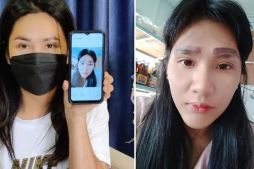 Không dám ra khỏi nhà suốt cả năm vì có 2 hàng lông mày
