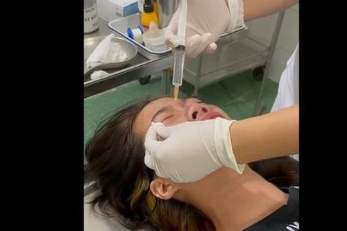 Hải Phòng: Đối tượng xịt hơi cay vào mặt cháu bé 15 tuổi bị truy tố
