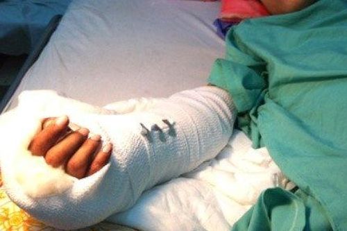 Lời nhắn nhủ của người chồng trong vụ chém lìa tay vợ