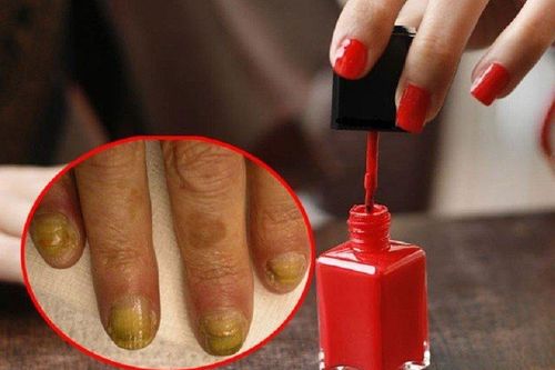 Tác hại khi sơn móng tay thường xuyên, không phải ai cũng biết