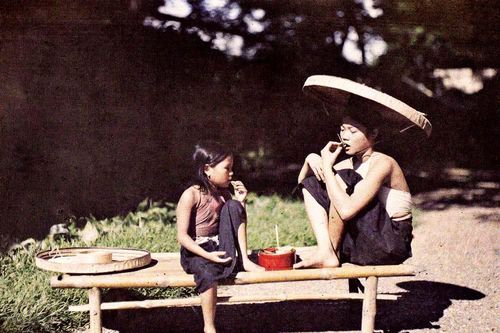 Đầu gối quá tai