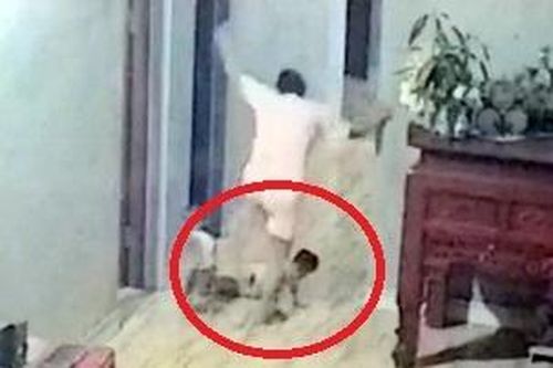 Dấu hiệu vi phạm của người mẹ đạp gãy xương đùi con trai