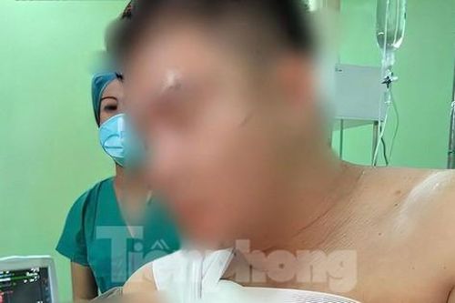Người đàn ông 39 tuổi bị khúc gỗ keo đâm thủng phổi, gãy 4 xương sườn