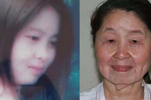 Cô gái 20 tuổi hóa bà lão chỉ sau một đêm 17 năm trước giờ ra sao?