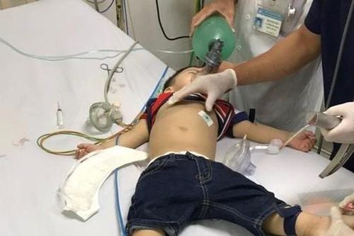 Bé trai 22 tháng tuổi ngưng tim, ngưng thở vì hóc thạch rau câu