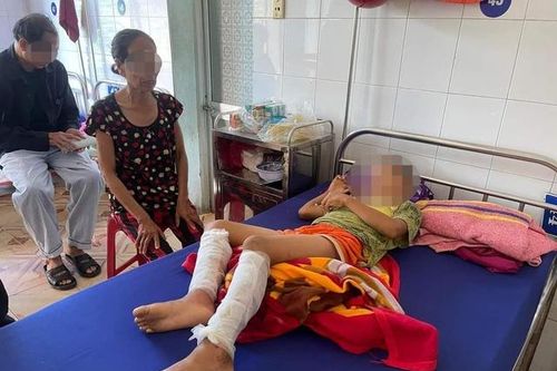 Cha đốt con vì nghi trộm tiền của hàng xóm: Sử dụng bạo lực để giáo dục là hành vi đáng trách