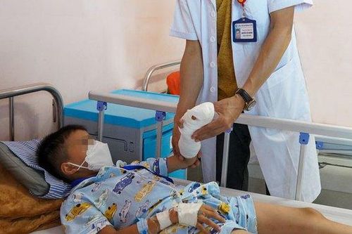 Giúp anh nấu ăn, bé 7 tuổi bị đứt gần lìa 2 ngón tay