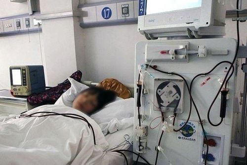 Vợ chồng trẻ cùng bị nhồi máu não vì ăn món này hàng ngày