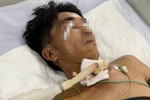 Người đàn ông nghi tự dùng dao cắt cổ, đâm bụng 'tự sát'