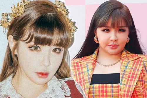 'Idol vạn người mê' Park Bom xuất hiện mũm mĩm, gương mặt khác lạ