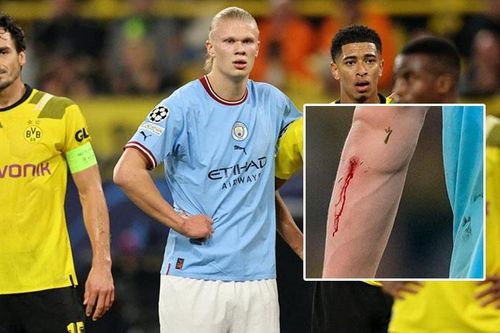 Vì sao HLV Man City vội vàng rút Haaland ra khỏi sân trong trận gặp Dortmund?