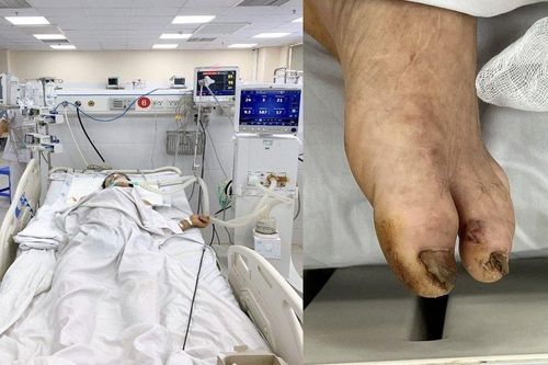 Cứu sống người đàn ông co cứng toàn thân sau khi cọc nhọn đâm vào chân