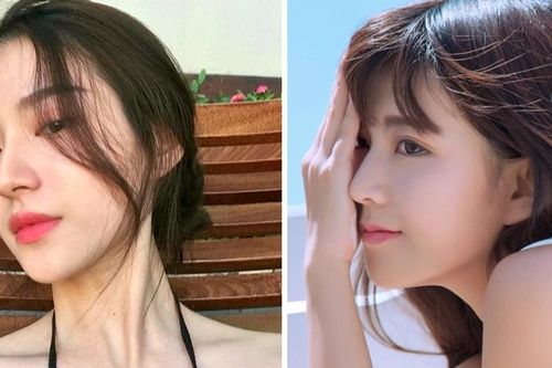 5 'đại kỵ' sau nâng mũi có thể khiến chị em gặp biến chứng nguy hiểm