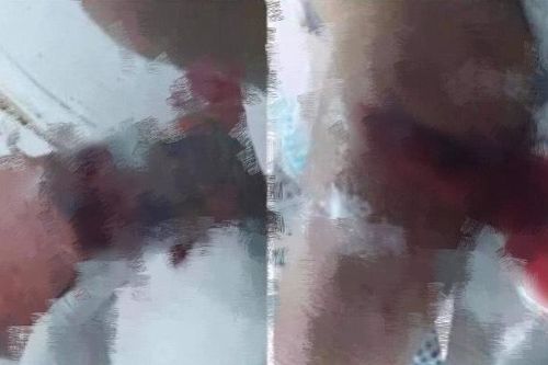 Phê chuẩn khởi tố, bắt tạm giam nam thanh niên chém bố và cậu ruột bạn gái trong ngày 'ra mắt'