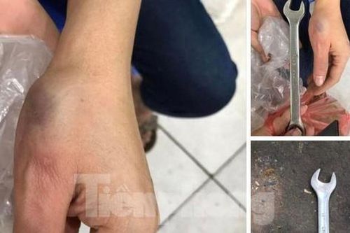 Hà Nội: Cờ lê sắt từ tầng cao chung cư rơi trúng người phụ nữ đang bế con