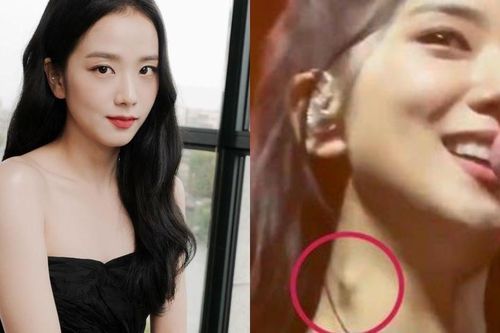 Căn bệnh của Jisoo BlackPink