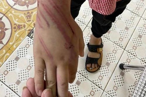 Diễn biến mới nhất vụ bé trai 8 tuổi bị bạo hành ở Hải Phòng