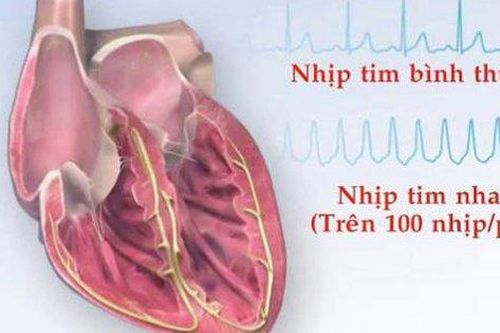 Bài thuốc hỗ trợ trị loạn nhịp tim do tâm huyết hư