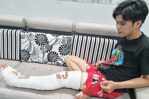 Giằng co với trật tự đô thị, người bán hàng rong bị xe đè gãy chân