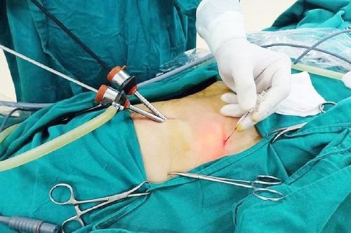 Người phụ nữ mất túi mật vì tự 'bắt bệnh'