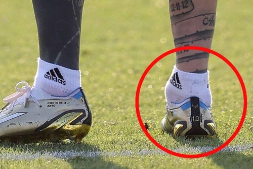 Mắt cá chân bất thường của Messi