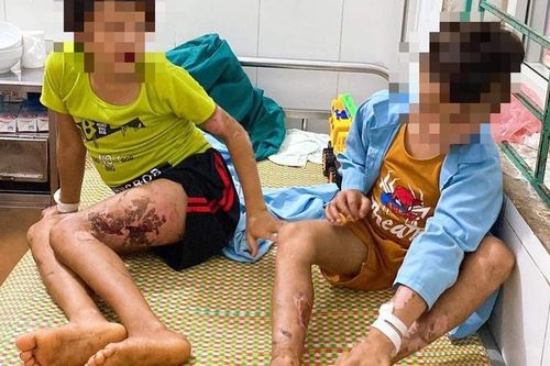 Liên tiếp trẻ bị tai nạn thương tích: Khuyến cáo của chuyên gia