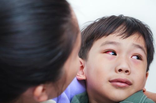 Viêm kết mạc do Adenovirus