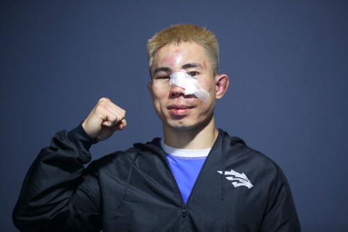 Gương mặt biến dạng của võ sĩ sau chiến thắng tại giải MMA Việt Nam