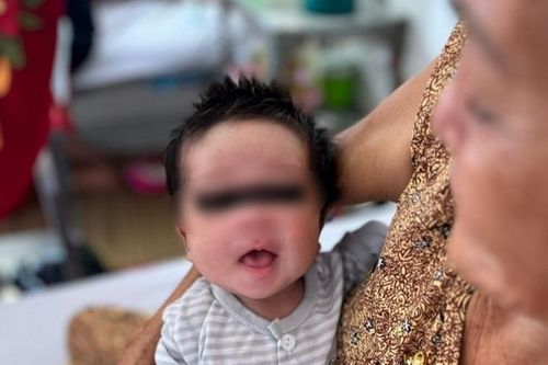 Cứu sống bé 16 ngày tuổi sốt cao, rốn lồi lên do mẹ không tiêm ngừa trong thai kỳ
