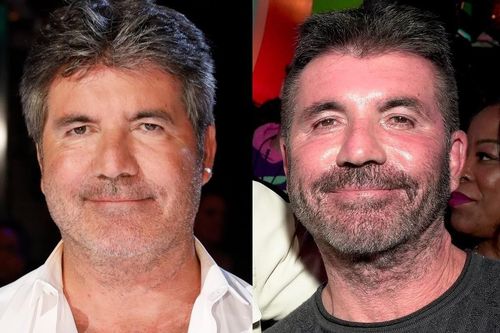 Gương mặt Simon Cowell thay đổi 'không thể nhận ra'