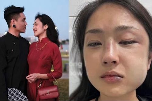Nghi ngờ bạn trai lăng nhăng, Misoa bị người yêu hành hung