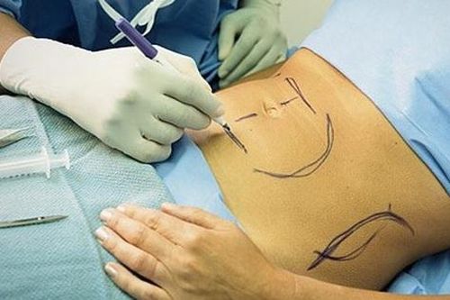 Thông tin mới nhất vụ cô gái tử vong sau khi đốt mỡ ở trung tâm thẩm mỹ