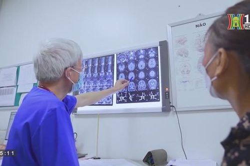 Cảnh giác với tình trạng đau đầu kéo dài