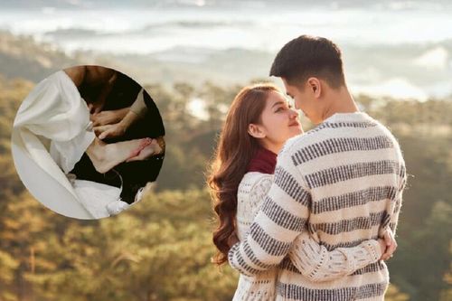 Á hậu Thùy Dung gặp sự cố trong đám cưới đến mức đi lại rất khó khăn