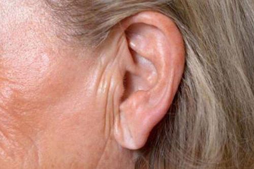 Dấu hiệu lạ xuất hiện ở tai cảnh báo cơn đau tim nguy hiểm