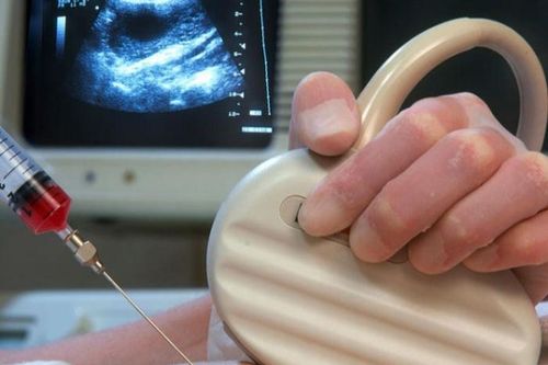 Choáng váng với kết quả xét nghiệm ADN: Thai nhi là con bố, không phải con mẹ
