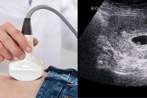 Hà Nội phê duyệt Đề án mở rộng tầm soát, chẩn đoán, điều trị một số bệnh, tật trước sinh và sơ sinh