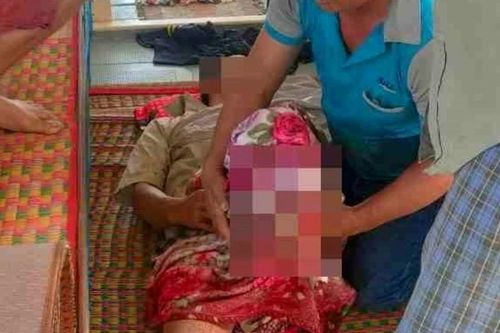 Cứu kịp thời thuyền viên bị dập nát mất bàn chân trái
