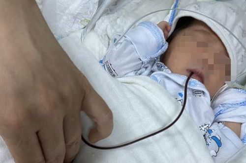 Cặp song sinh mắc bệnh hiếm sau 18 tiếng chào đời