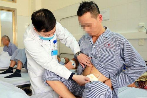 U ác sau phúc mạc to nhanh vì tự uống thuốc nam chữa bệnh