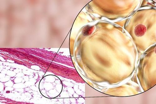 Kháng insulin ảnh hưởng đến sinh sản của phụ nữ, điều trị thế nào?