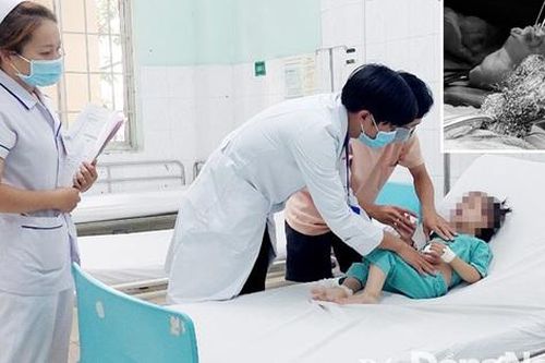 Bé gái 3 tuổi mắc hội chứng nuốt tóc, bác sĩ khuyến cáo cha mẹ nên theo dõi sát con