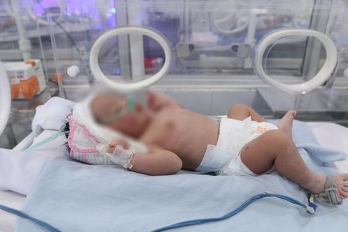 Hải Phòng: Cứu sống bé trai sơ sinh dị tật bị bỏ rơi bên đường