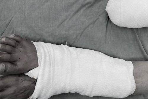Việt Nam lần đầu tiên thực hiện 'nuôi' chân bị đứt rời vào chân lành chờ nối chi