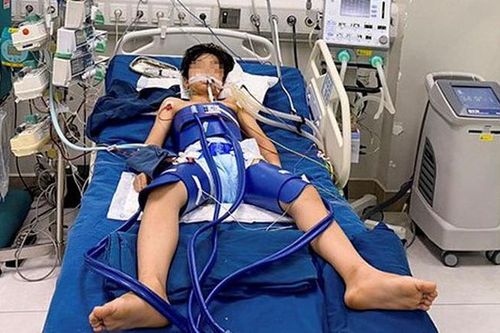 Bé 12 tuổi bị ngừng tim sau cú sút bóng và khuyến cáo của chuyên gia