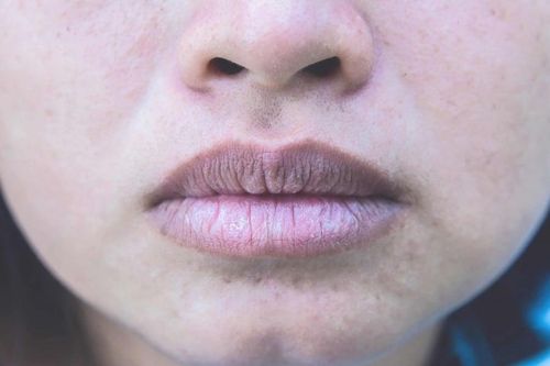 4 dấu hiệu bất thường trên mặt cảnh báo bệnh gan, khám nhanh kẻo 'hết đường cứu'