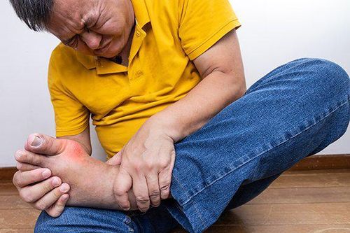 Lợi ích của tập luyện với người bệnh gout, thực hành thế nào?