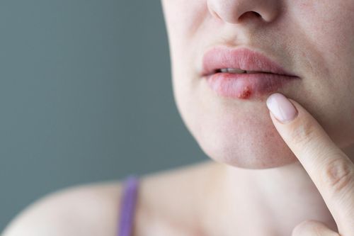 Căn bệnh truyền nhiễm không thể chữa khỏi hoàn toàn