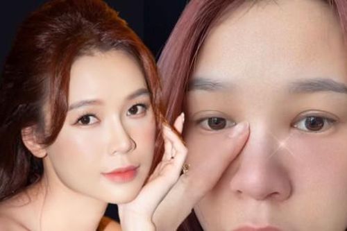 Sam tiết lộ tình trạng sức khỏe đáng quan ngại, nhan sắc đứng trước nguy cơ bị ảnh hưởng