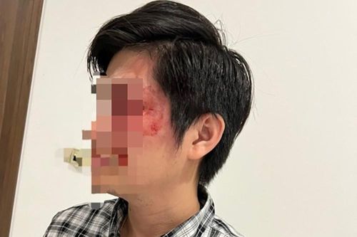 UBND TP.HCM yêu cầu xử lý nghiêm vụ chủ chó đánh cư dân nhập viện